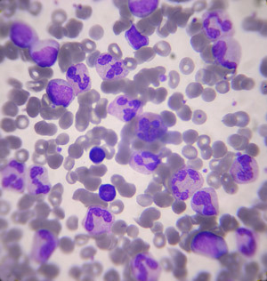 I globuli bianchi del sangue sono incaricati di difendere il corpo contro i germi invasori.  