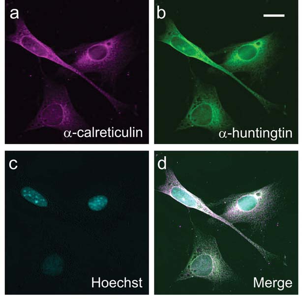 In questa immagine al microscopio proveniente dal laboratorio di Truant, vengono usati colori diversi per mostrare diverse parti della cellula. Il nucleo viene evidenziato con un colorante detto 'Hoechst'. L'huntingtina è stata resa verde fluorescente in modo da poterla localizzare nella cellula.