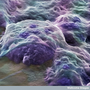 Queste cellule staminali embrionali, che provengono da un embrione umano, possono trasformarsi in qualsiasi tipo di cellula. Ma sono difficili da reperire e non possono essere utilizzate per trattare direttamente l'HD.