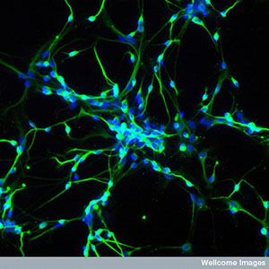 Le cellule staminali possono essere utilizzate per coltivare neuroni in laboratorio. Questi neuroni sono strumenti davvero potenti per studiare malattie come l'HD.