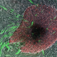In verde e rosso "Cellule Staminali pluripotenti indotte" in crescita rispetto alle cellule circostanti della pelle.