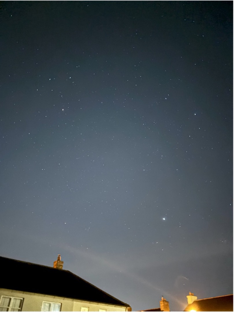 Ogni persona che convive con la malattia di Huntington brilla in modo unico, come una stella nel cielo, aggiungendo la sua luce al mondo in modi che solo lei può fare. 
