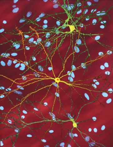 Immagini di colture di neuroni dal laboratorio di Finkbeiner. Le cellule in verde e giallo sono state ' etichettate ' e quindi si illuminano mostrando cosi la forma delle cellule. Immagine cortesemente fornita da : Dr S. Finkbeiner   