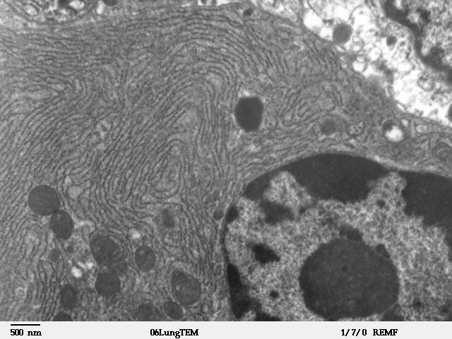 Le linee ondulate in questa immagine rappresentano il " reticolo endoplasmatico " di una cellula - i depositi di immagazzinamento del calcio. I recettori Ryanodine si trovano in queste strutture.  