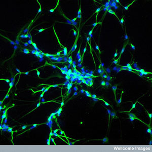 Le cellule staminali possono essere utilizzate per far crescere neuroni in laboratorio. Questi neuroni sono mezzi molto potenti per studiare malattie come la MH..  